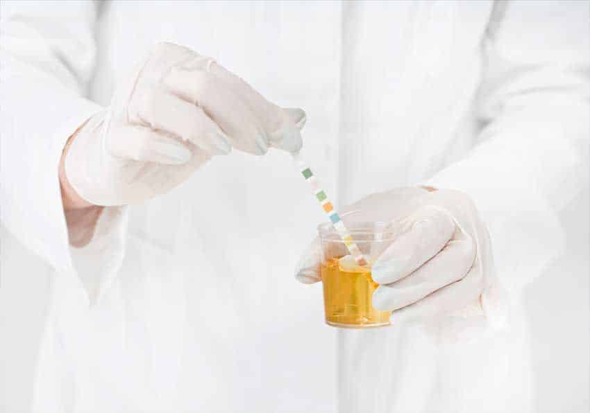 drugs-and-alcohol-test-supplier