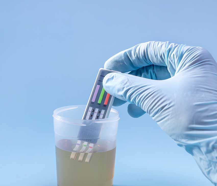reading-drug-of-abuse-test-results